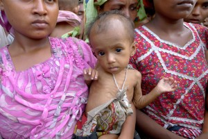 malnourishedbaby